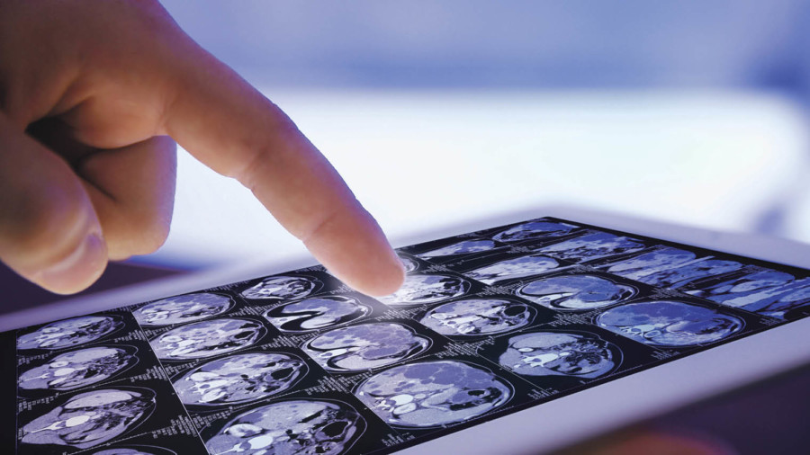 Finger on tablet displaying brain scans