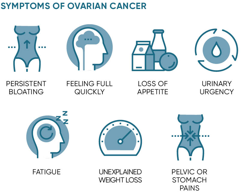 Symptoms of ovarian cancer