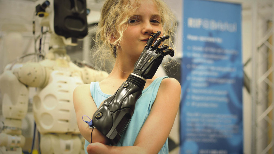 Tilly Lockey, who lost both hands to meningitis as a baby, with her a custom-built 3D printed prosthetic